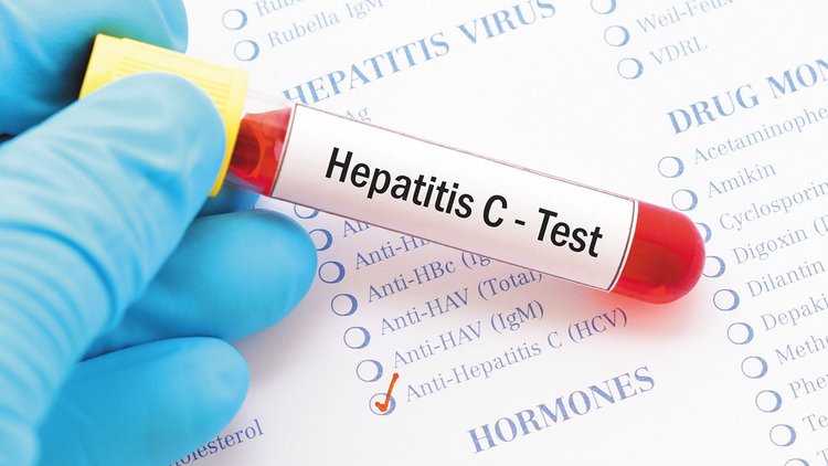 hepatita-c-test
